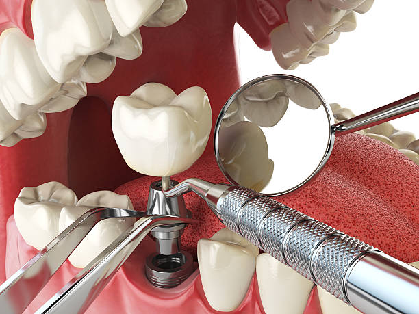 Best 24-Hour Emergency Dentist in Spencerville, MD